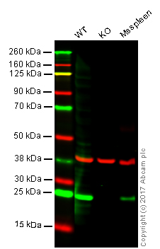 Western blot - Anti-Lysophospholipase 1/LPL-I antibody [EPR3666] (AB91600)