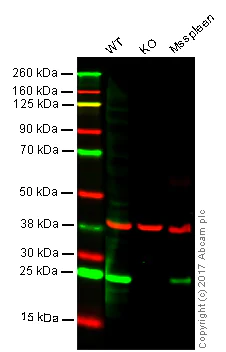 Western blot - Anti-Lysophospholipase 1/LPL-I antibody [EPR3666] - BSA and Azide free (AB247525)