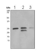 Western blot - Anti-Lysophospholipase 1/LPL-I antibody [EPR3666] - BSA and Azide free (AB247525), expandable thumbnail