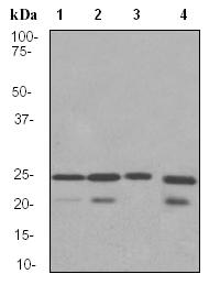 Western blot - Anti-Lysophospholipase 1/LPL-I antibody [EPR3667] - BSA and Azide free (AB239901), expandable thumbnail
