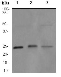 Western blot - Anti-Lysophospholipase 1/LPL-I antibody [EPR3667] - BSA and Azide free (AB239901), expandable thumbnail