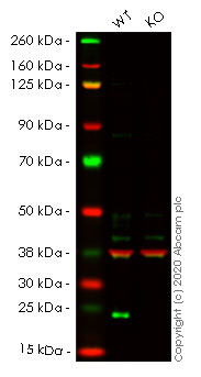 Western blot - Anti-Lysophospholipase 1/LPL-I antibody [EPR3667] - BSA and Azide free (AB239901), expandable thumbnail