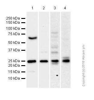 Western blot - Anti-Lysophospholipase 1/LPL-I antibody [EPR3667] - BSA and Azide free (AB239901), expandable thumbnail