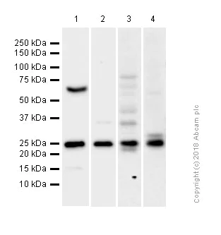 Western blot - Anti-Lysophospholipase 1/LPL-I antibody [EPR3667] - BSA and Azide free (AB239901)