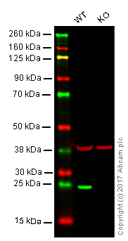 Western blot - Anti-Lysophospholipase 1/LPL-I antibody [EPR3667] - BSA and Azide free (AB239901), expandable thumbnail