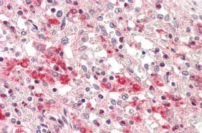 Immunohistochemistry (Formalin/PFA-fixed paraffin-embedded sections) - Anti-Lysosomal acid lipase/LAL antibody [1F9] (AB219113), expandable thumbnail