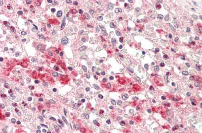 Immunohistochemistry (Formalin/PFA-fixed paraffin-embedded sections) - Anti-Lysosomal acid lipase/LAL antibody [1F9] (AB219113)