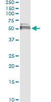 Immunoprecipitation - Anti-Lysosomal acid lipase/LAL antibody [1F9] (AB219113), expandable thumbnail