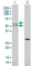 Western blot - Anti-Lysosomal acid lipase/LAL antibody [1F9] (AB219113), expandable thumbnail