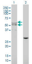 Western blot - Anti-Lysosomal acid lipase/LAL antibody [1F9] (AB219113)