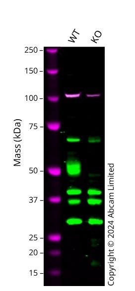 Western blot - Anti-Lysosomal acid lipase/LAL antibody [1F9] (AB219113), expandable thumbnail