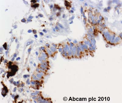 Immunohistochemistry (Formalin/PFA-fixed paraffin-embedded sections) - Anti-Lysosomal acid lipase/LAL antibody [9G7F12] (AB36597)