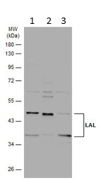 Western blot - Anti-Lysosomal acid lipase/LAL antibody (AB154356)