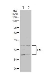 Western blot - Anti-Lysosomal acid lipase/LAL antibody (AB154356)