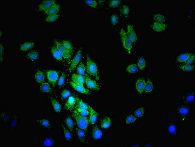 Immunocytochemistry/ Immunofluorescence - Anti-Lysosomal acid lipase/LAL antibody (AB236736)