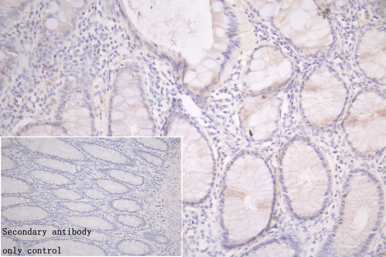 Immunohistochemistry (Formalin/PFA-fixed paraffin-embedded sections) - Anti-Lysosomal acid lipase/LAL antibody (AB236736)