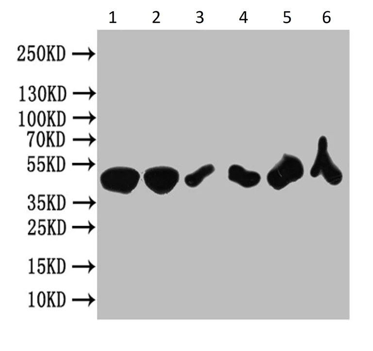 Western blot - Anti-Lysosomal acid lipase/LAL antibody (AB236736)