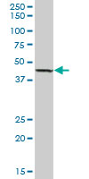 Western blot - Anti-Lysosomal acid lipase/LAL antibody (AB89771)