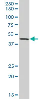 Western blot - Anti-Lysosomal acid lipase/LAL antibody (AB89771)