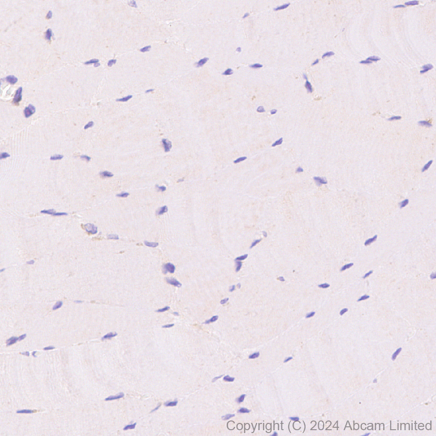 Immunohistochemistry (Formalin/PFA-fixed paraffin-embedded sections) - Anti-Lysosomal acid lipase/LAL antibody [EPR29160-155] (AB323282), expandable thumbnail