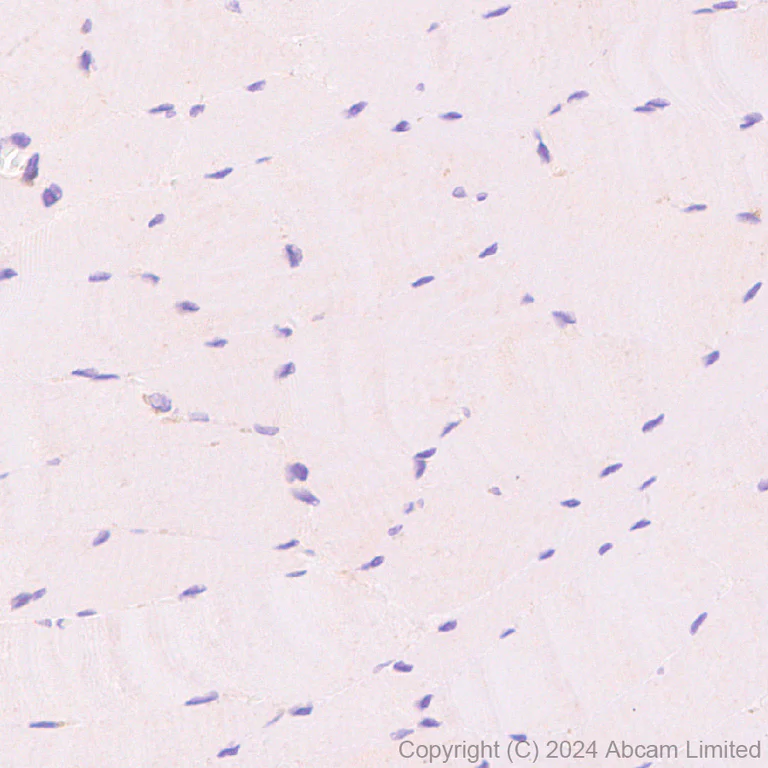 Immunohistochemistry (Formalin/PFA-fixed paraffin-embedded sections) - Anti-Lysosomal acid lipase/LAL antibody [EPR29160-155] (AB323282)