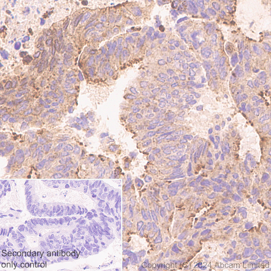 Immunohistochemistry (Formalin/PFA-fixed paraffin-embedded sections) - Anti-Lysosomal acid lipase/LAL antibody [EPR29160-155] (ab323282), expandable thumbnail