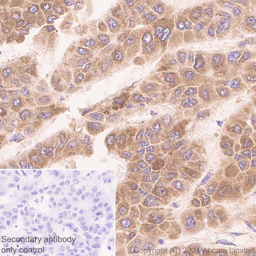 Immunohistochemistry (Formalin/PFA-fixed paraffin-embedded sections) - Anti-Lysosomal acid lipase/LAL antibody [EPR29160-155] (AB323282), expandable thumbnail