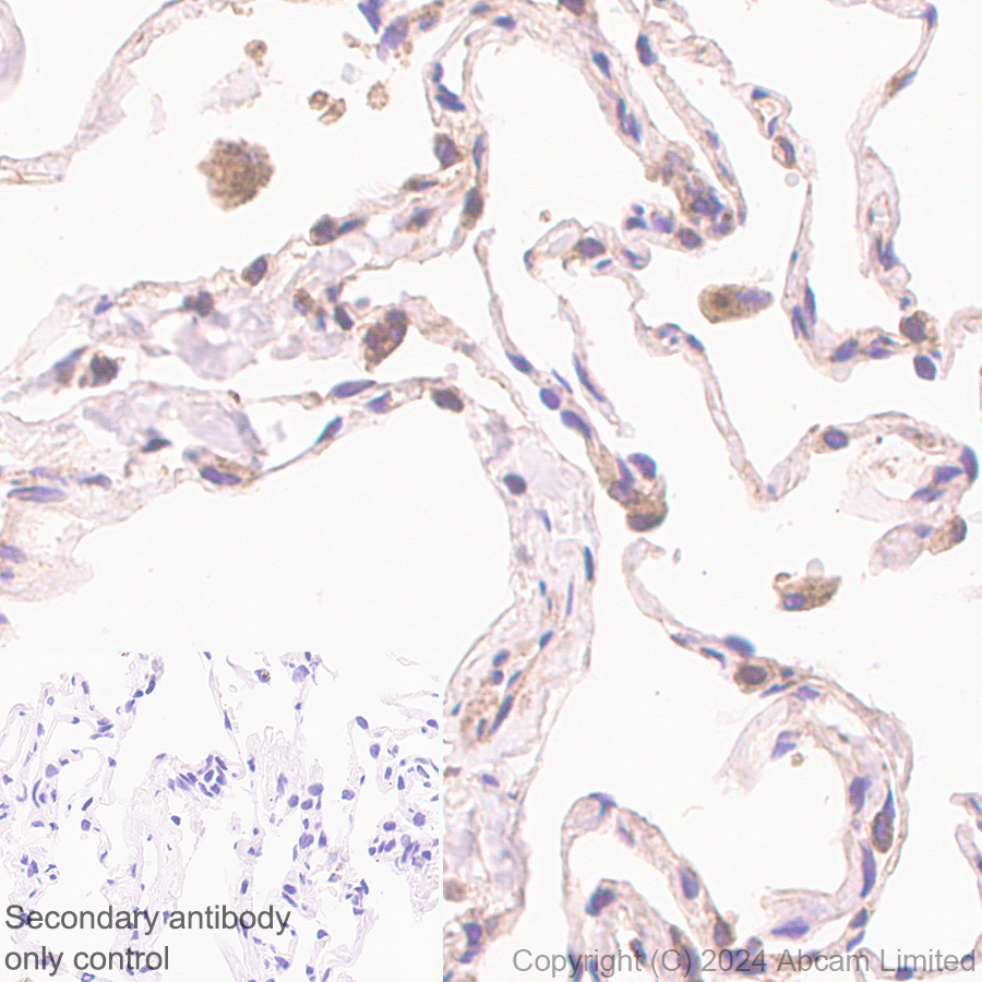 Immunohistochemistry (Formalin/PFA-fixed paraffin-embedded sections) - Anti-Lysosomal acid lipase/LAL antibody [EPR29160-155] (ab323282), expandable thumbnail