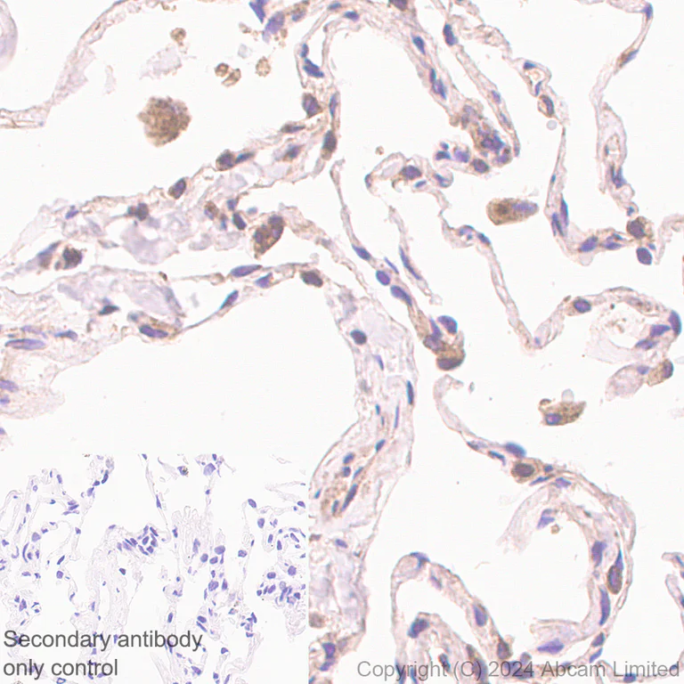 Immunohistochemistry (Formalin/PFA-fixed paraffin-embedded sections) - Anti-Lysosomal acid lipase/LAL antibody [EPR29160-155] (AB323282)