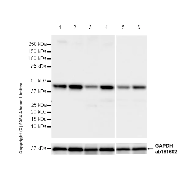 Western blot - Anti-Lysosomal acid lipase/LAL antibody [EPR29160-155] (AB323282)