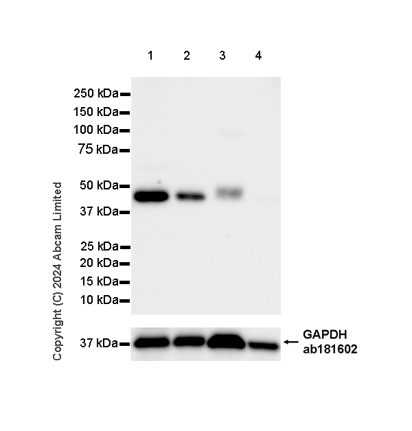 Western blot - Anti-Lysosomal acid lipase/LAL antibody [EPR29160-155] (AB323282), expandable thumbnail