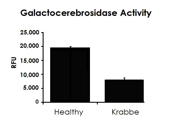 Fluorescent Cell Imaging - Lysosomal Galactocerebrosidase (GALC) Analysis Kit (AB253371)