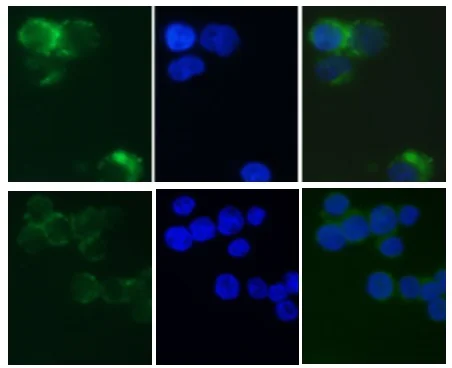 Functional Studies - Lysosomal Intracellular Activity Assay Kit (AB234622)