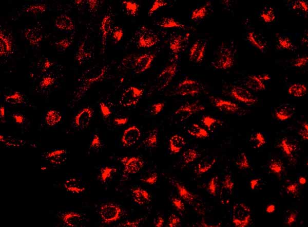 Fluorescence Microscopy - Lysosomal Staining Kit - NIR Fluorescence - Cytopainter (AB176746), expandable thumbnail