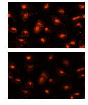 Fluorescence Microscopy - Lysosomal Staining Kit - Orange - Cytopainter (AB138895), expandable thumbnail