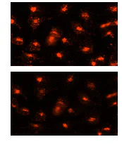 Fluorescence Microscopy - Lysosomal Staining Kit - Orange - Cytopainter (AB138895)