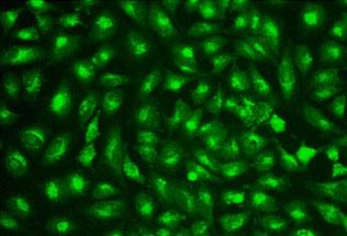 Fluorescence Microscopy - Lysosomal Staining Reagent - Green - Cytopainter (AB176826), expandable thumbnail