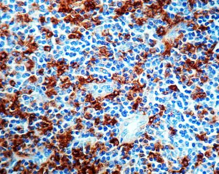 Immunohistochemistry (Formalin/PFA-fixed paraffin-embedded sections) - Anti-Lysozyme antibody (AB2408)