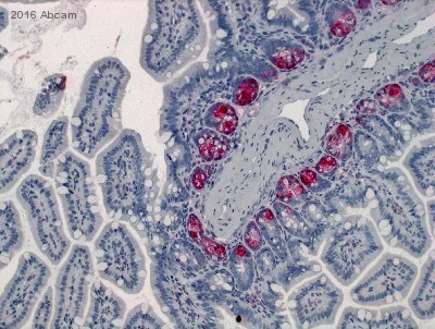 Immunohistochemistry (Formalin/PFA-fixed paraffin-embedded sections) - Anti-Lysozyme antibody [EPR2994(2)] (AB108508)