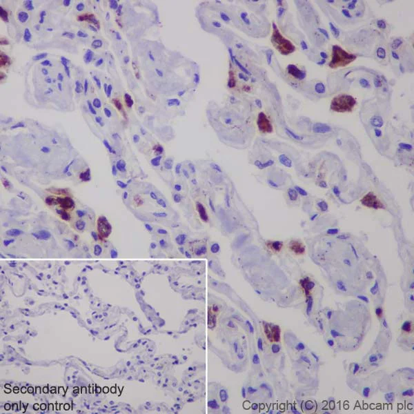 Immunohistochemistry (Formalin/PFA-fixed paraffin-embedded sections) - Anti-Lysozyme antibody [EPR2994(2)] - BSA and Azide free (AB185129)
