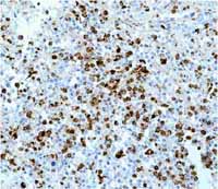 Immunohistochemistry (Formalin/PFA-fixed paraffin-embedded sections) - Anti-Lysozyme antibody [EPR2994(2)] - BSA and Azide free (ab185129), expandable thumbnail