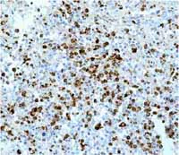 Immunohistochemistry (Formalin/PFA-fixed paraffin-embedded sections) - Anti-Lysozyme antibody [EPR2994(2)] - BSA and Azide free (AB185129)