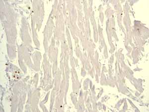 Immunohistochemistry (Formalin/PFA-fixed paraffin-embedded sections) - Anti-Lysozyme antibody [EPR2994(2)] - BSA and Azide free (ab185129), expandable thumbnail