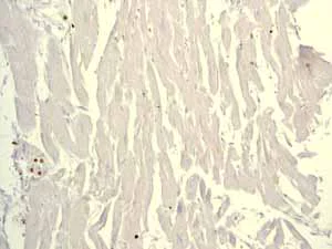 Immunohistochemistry (Formalin/PFA-fixed paraffin-embedded sections) - Anti-Lysozyme antibody [EPR2994(2)] - BSA and Azide free (AB185129)