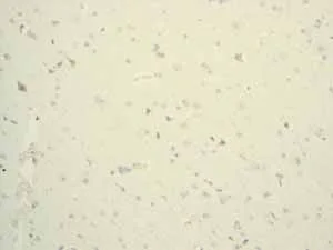 Immunohistochemistry (Formalin/PFA-fixed paraffin-embedded sections) - Anti-Lysozyme antibody [EPR2994(2)] - BSA and Azide free (AB185129)