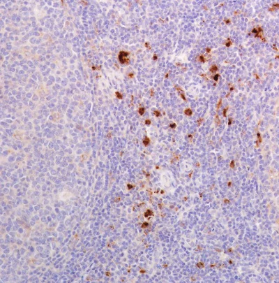 Immunohistochemistry (Formalin/PFA-fixed paraffin-embedded sections) - Anti-Lysozyme antibody [SP329] (AB223503)