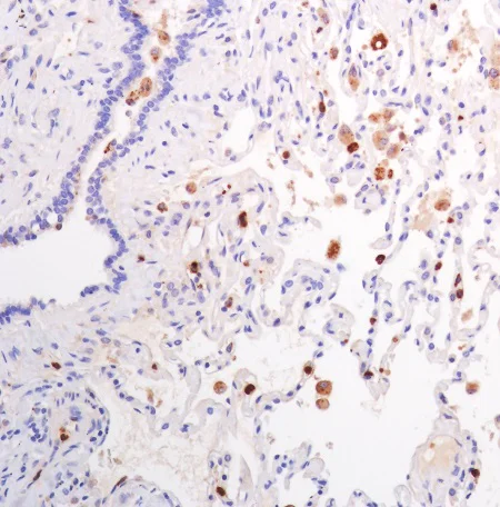 Immunohistochemistry (Formalin/PFA-fixed paraffin-embedded sections) - Anti-Lysozyme antibody [SP329] (AB223503)