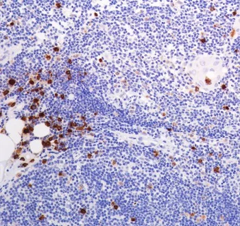 Immunohistochemistry (Formalin/PFA-fixed paraffin-embedded sections) - Anti-Lysozyme antibody [SP329] (AB223503)