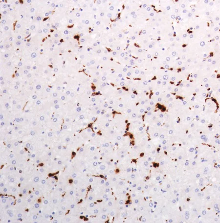 Immunohistochemistry (Formalin/PFA-fixed paraffin-embedded sections) - Anti-Lysozyme antibody [SP329] (AB223503)