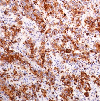Immunohistochemistry (Formalin/PFA-fixed paraffin-embedded sections) - Anti-Lysozyme antibody [SP329] (AB223503)